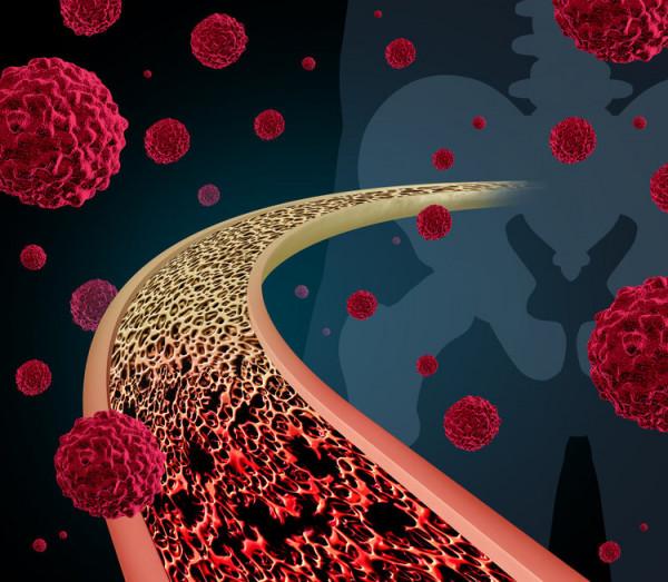 確診不到兩年，天才醫生37歲因癌去世，他的經歷，值得反思