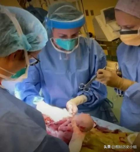 世界首例 加拿大重病女子依靠ECMO產下孩子 醫生稱之為醫學奇蹟