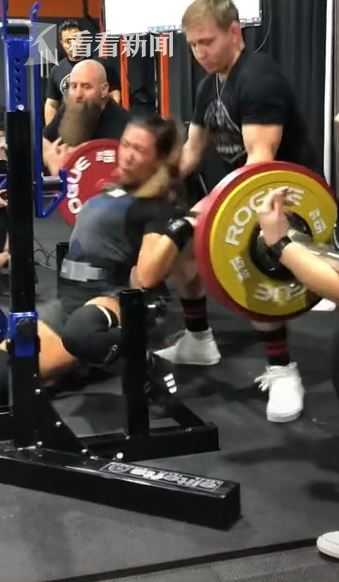 女子舉167公斤深蹲當場斷臂 骨頭差點刺穿面板