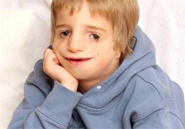 英國男子臉部畸形，憑魅力迎娶美女大學生，孩子出生後笑不出來了