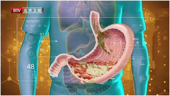 胃不好的人注意了，6種食物醫生都勸你少吃！這些才是真正的養胃法，早學早受益