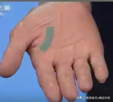 手是健康的鏡子,10種常見病,從手上就能看出來 手是健康的鏡子,10種常見病,從手上就能看出來