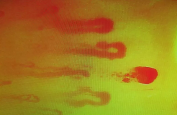 天氣轉涼,保護好我們的“第二心臟”!面板乾裂、手腳冰涼,血壓升高都與之相關 天氣轉涼,保護好我們的“第二心臟”!面板乾裂、手腳冰涼,血壓升高都與之相關