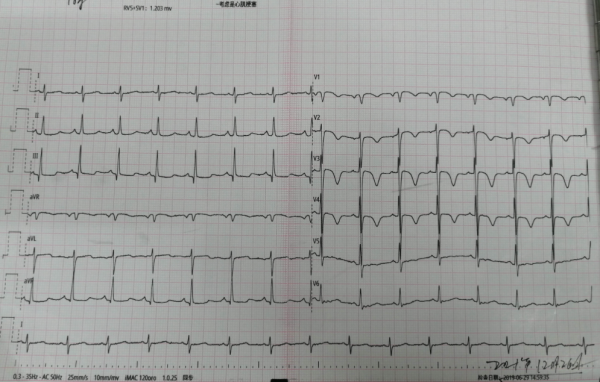 53歲男子心累氣促沒住院,回家途中腰痛半小時去世,死因卻成迷? 53歲男子心累氣促沒住院,回家途中腰痛半小時去世,死因卻成迷?