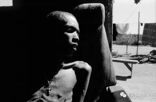 艾滋病橫行的非洲國家辛巴威 那些等死的艾滋病患者