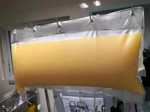 每天1瓶可樂起步，15歲少年突發中風！2次送進ICU搶救，爸媽崩潰