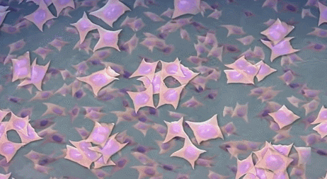 4位不同疾病患者的自述:幹細胞技術讓我們擁有了全新的生活 4位不同疾病患者的自述:幹細胞技術讓我們擁有了全新的生活