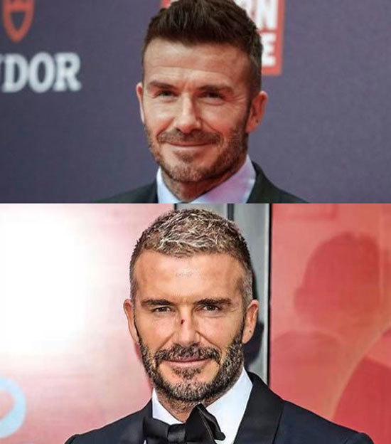 貝克漢姆47歲愛妻上節目,罕見綻放笑容,“塑膠嘴唇”引整容質疑 貝克漢姆47歲愛妻上節目,罕見綻放笑容,“塑膠嘴唇”引整容質疑