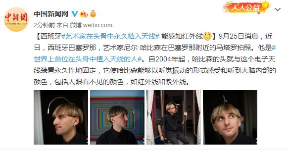 西班牙藝術家在頭骨中永久植入天線 能感知紅外線