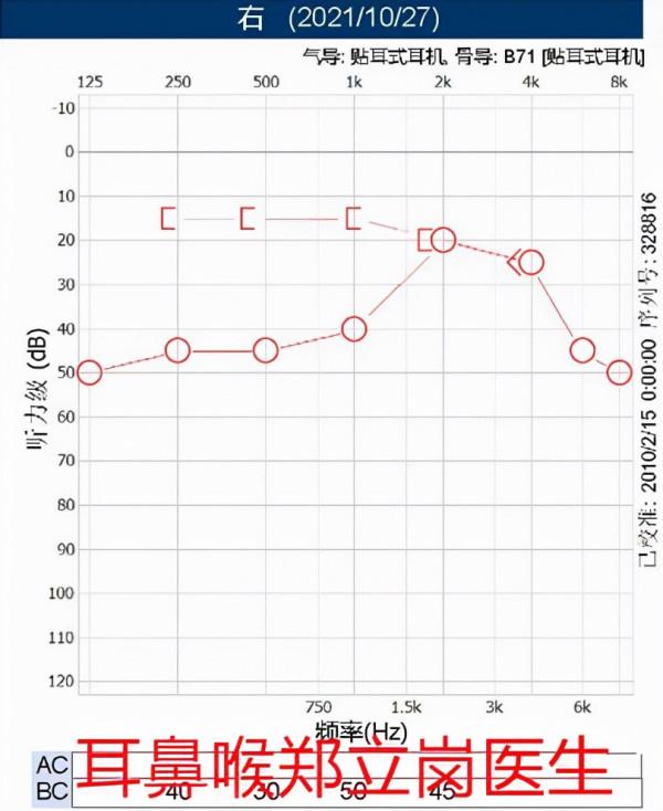 耳內鏡中耳炎微創手術想做局麻，找耳鼻喉鄭立崗醫生