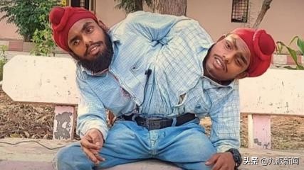 印度連體雙胞胎被父母遺棄，收容所長大獲政府工作領兩人工資