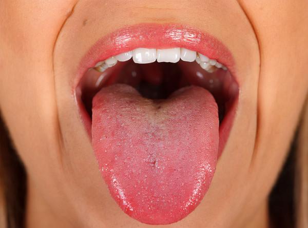 “舌為心之苗”:心臟不好,舌頭或許有4個變化,對照自查下 “舌為心之苗”:心臟不好,舌頭或許有4個變化,對照自查下