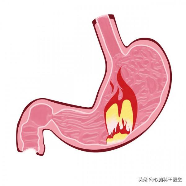 正確用法：奧美拉唑（服藥時間、配伍禁忌、劑型選擇)全介紹