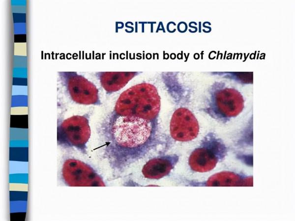 鸚鵡熱只是一種鳥病嗎?7名患者1例醫治無效,醫生帶你瞭解一下 鸚鵡熱只是一種鳥病嗎?7名患者1例醫治無效,醫生帶你瞭解一下
