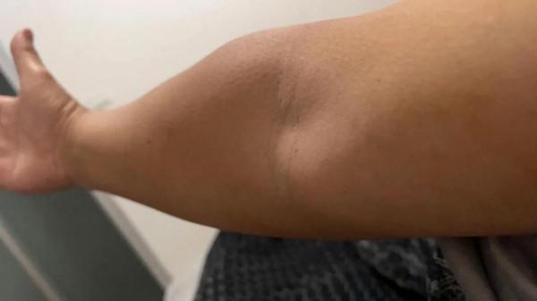 艾灸調理身體效果看的見