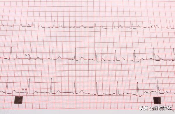 心律失常的危害大嗎?做好這4點,或能防止意外發生 心律失常的危害大嗎?做好這4點,或能防止意外發生