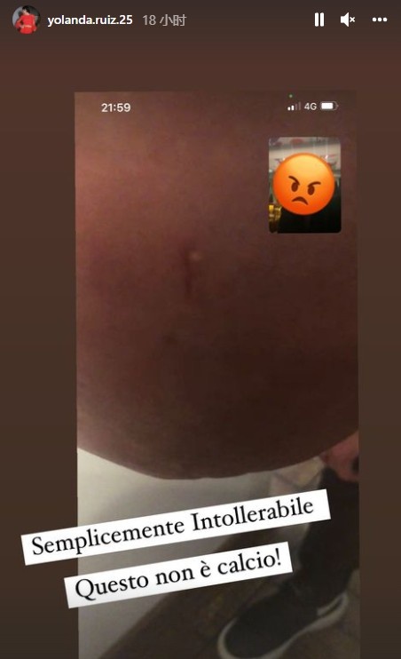 雷納頭部被球迷用硬幣砸出小坑，妻子怒斥：不可忍受，這不是足球