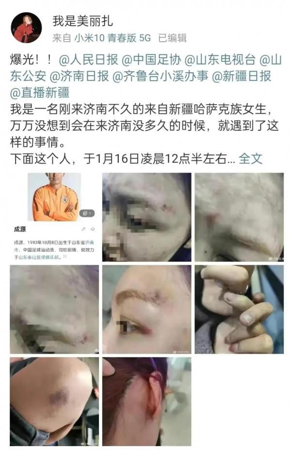 山東泰山隊前鋒成源火了,不是因為球技,而是因為酒後鬧事 山東泰山隊前鋒成源火了,不是因為球技,而是因為酒後鬧事