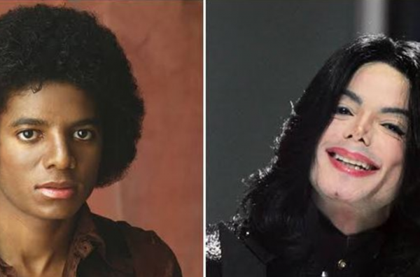 有多少黑人正在將自己漂白？