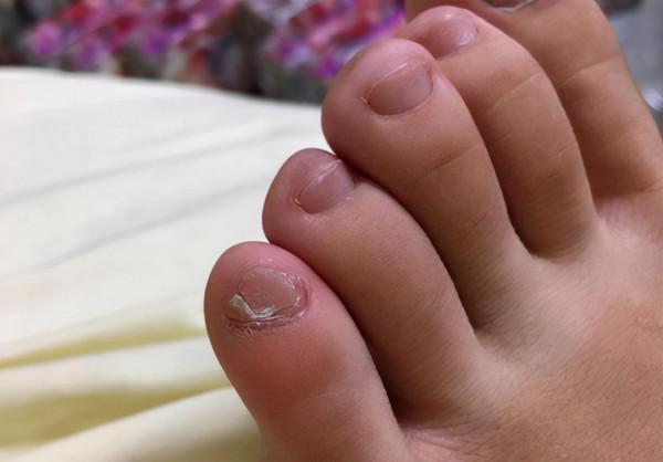 小腳趾甲長成兩瓣是啥人？據說朱元璋刀砍認親，或是純種漢人後代