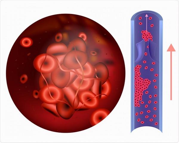 第一個被冰凍的人貝德福德,原定在50年後解封,現在怎麼樣了? 第一個被冰凍的人貝德福德,原定在50年後解封,現在怎麼樣了?