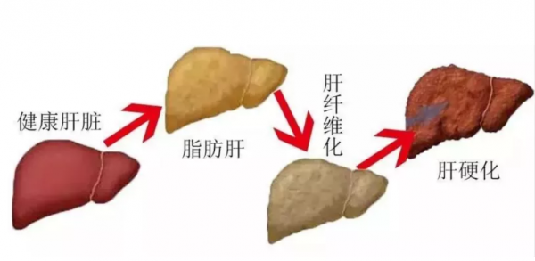 3個月瘦了25斤，36歲開始健康新生活