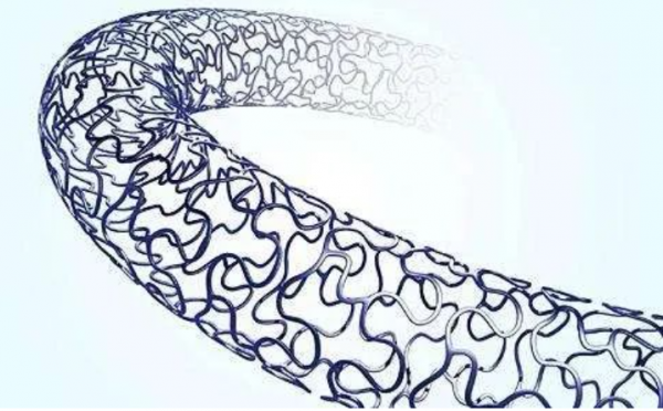 血管介入植入材料的創新與發展 血管介入植入材料的創新與發展