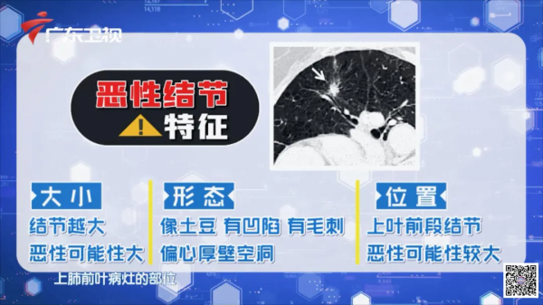 潤肺三寶扎+護肺簡運動,讓你冬日少肺燥、少咳喘 潤肺三寶扎+護肺簡運動,讓你冬日少肺燥、少咳喘