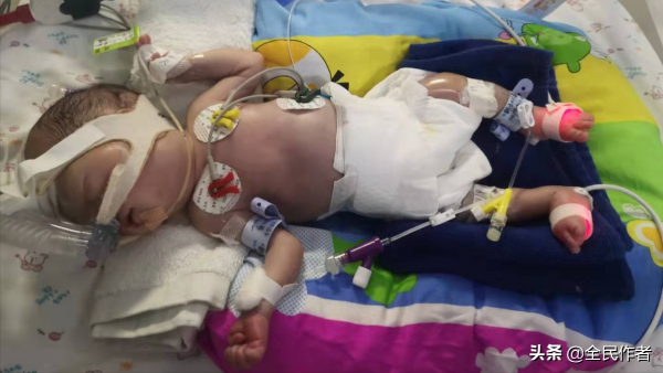 出生28天了,他卻還沒有被媽媽抱過 出生28天了,他卻還沒有被媽媽抱過