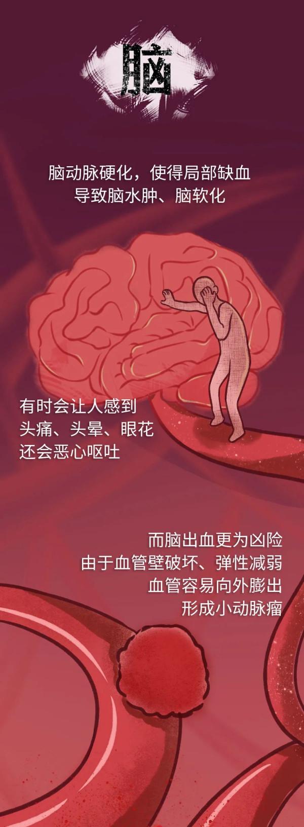 人體裡的沉默殺手，正在偷偷傷害爸媽