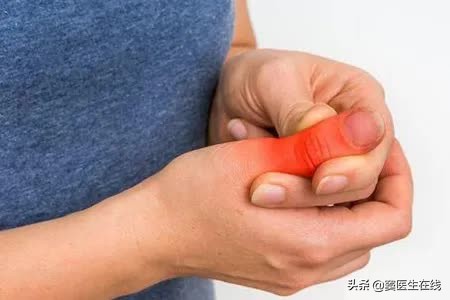 手指關節疼痛、僵硬，是怎麼回事？是類風溼嗎？