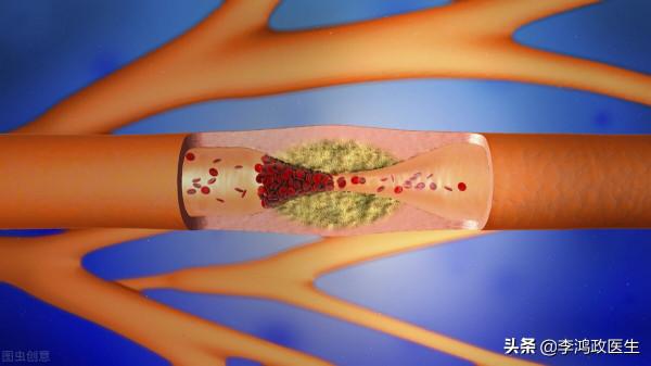 女子胸悶,就醫時測不到血壓摸不著脈搏,醫生:東方美人病 女子胸悶,就醫時測不到血壓摸不著脈搏,醫生:東方美人病