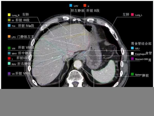 CT斷層解剖圖譜最全總結「推薦收藏」 CT斷層解剖圖譜最全總結「推薦收藏」