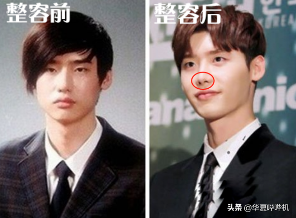 明星大型“翻車”現場，她們是如何整容變毀容的