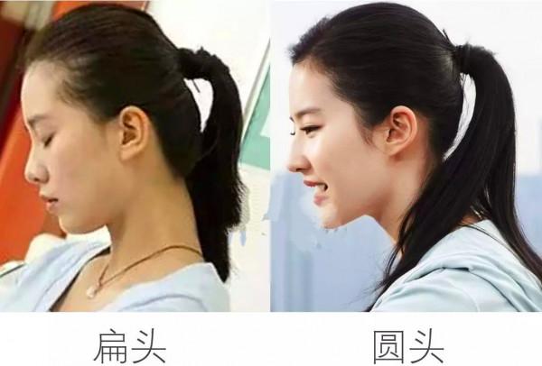 睡姿不當會導致新生兒頭骨變形,不少新手媽媽還不懂,及時糾正 睡姿不當會導致新生兒頭骨變形,不少新手媽媽還不懂,及時糾正