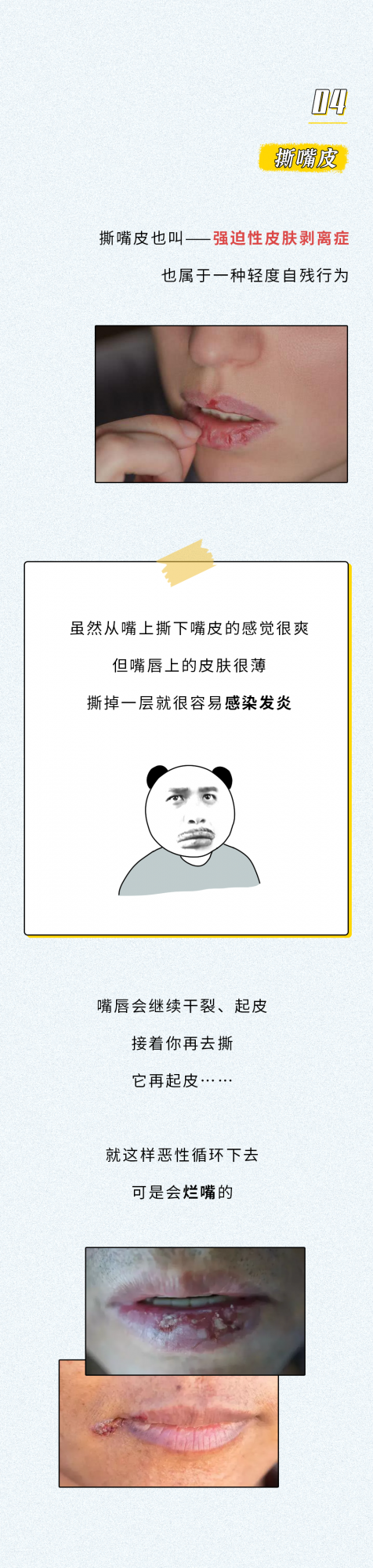 這11個不起眼的“小習慣”,可能會把你送進醫院…… 這11個不起眼的“小習慣”,可能會把你送進醫院……