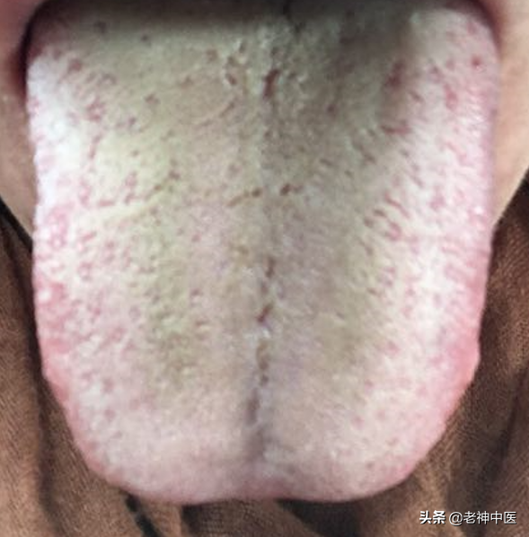 胃痛、胃脹、胃輕癱，糖尿病胃腸病變的中醫治療