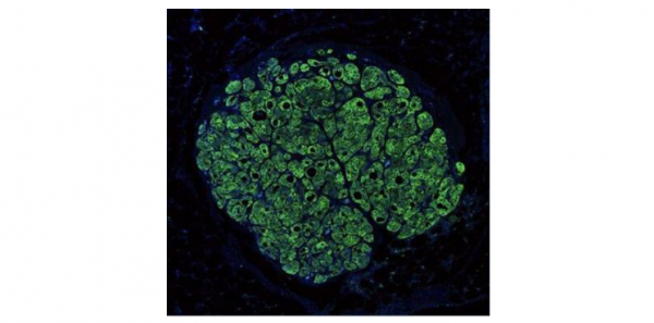 知料 | 給身體換個“零件”,用人造器官“續命” 知料 | 給身體換個“零件”,用人造器官“續命”