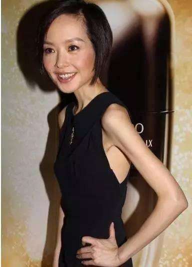 &OpenCurlyDoubleQuote;內卷&rdquo;下暴瘦的10位女星，有人瘦到22公斤，體力不支只能坐輪椅