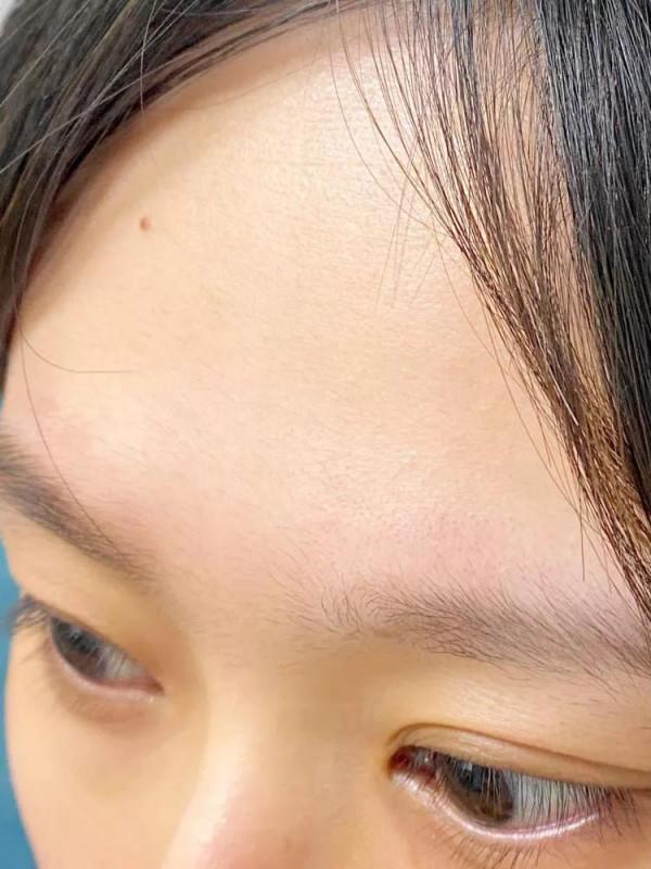 格局小了！！是我小看阿達帕林了