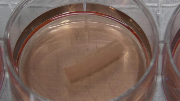 知料 | 給身體換個“零件”,用人造器官“續命” 知料 | 給身體換個“零件”,用人造器官“續命”