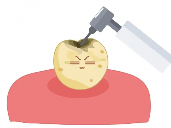 想要補個牙,反而被磨了個大洞? 想要補個牙,反而被磨了個大洞?