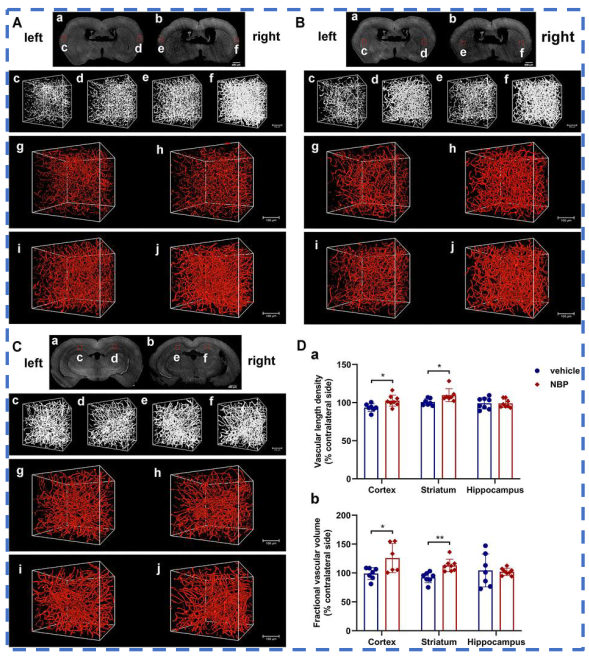 《Frontiers in Pharmacology》:丁苯酞促進TIA模型小鼠血管新生 《Frontiers in Pharmacology》:丁苯酞促進TIA模型小鼠血管新生
