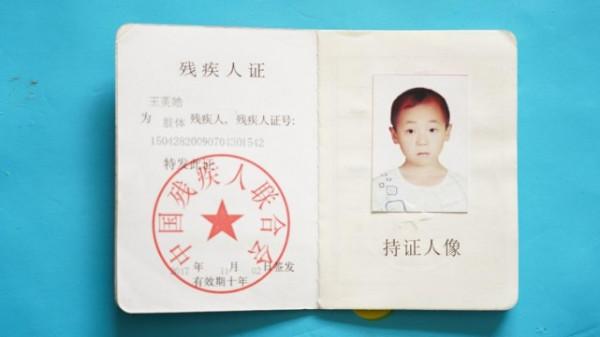 女子意外懷孕後不顧反對生下雙胞胎，醫生看後斷言：活不過18歲