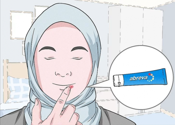 如何治癒唇皰疹外殼