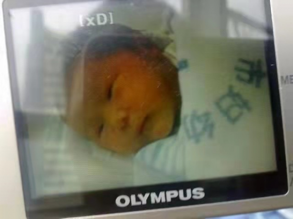 三年生育二胎血淚史