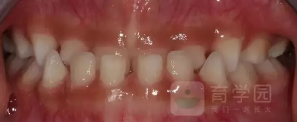 這幾個小習慣不改掉,小心娃會變醜受罪還費錢 這幾個小習慣不改掉,小心娃會變醜受罪還費錢