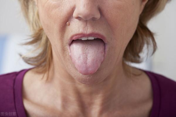 一位中藥師的課堂筆記：治療脾虛的中藥方子大全，默默收藏備用