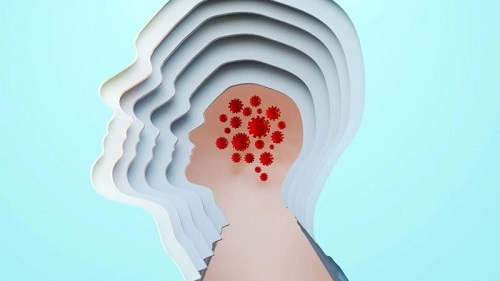 英媒：老年痴呆發病元兇被逐漸揭露 細菌和病毒有可能成為焦點