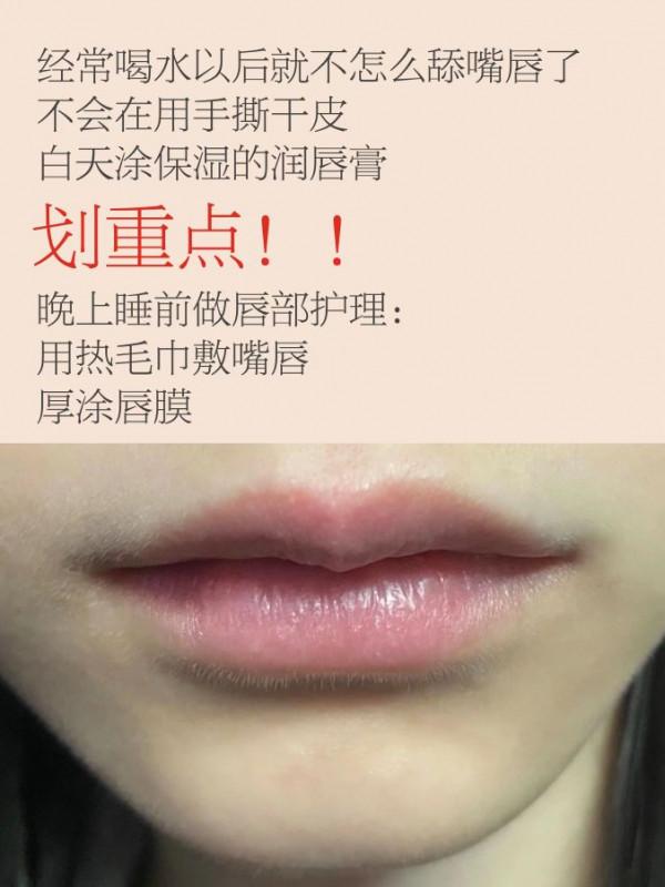 不能忽視的嘴唇護理丨唇部問題乾貨分享